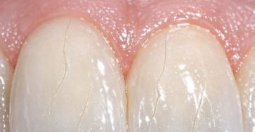 632951515 122208600530567604 2050528903233472960 n