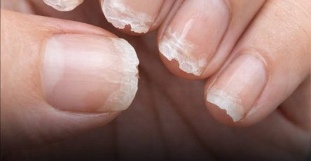 634854693 122208916868567604 1254882028431801563 n