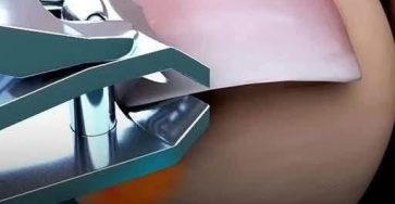 761627505 122544247934001353 6682610675650074841 n